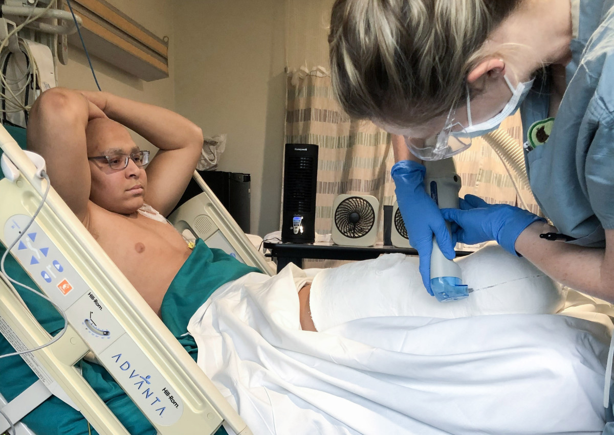 After getting an early cast sawed off, Thomas has three prosthetics now: one for football, one for lifting and one for everyday life.